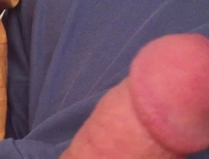 Surprise Dick