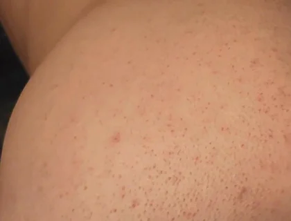 Big Black Dildo Fucks My Ass