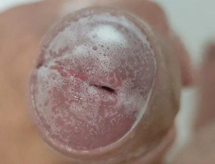 Extreme Burning Sensation Makes the Glans Foam with Arousal.