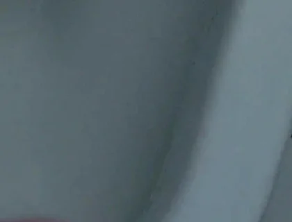 Homemade Method for Freezing the Penis.