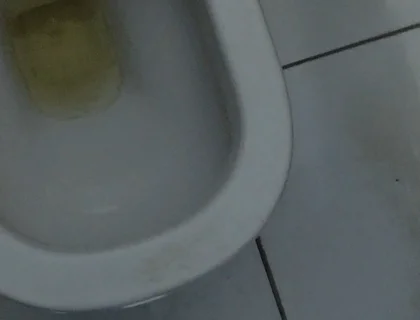 Homemade Method for Freezing the Penis