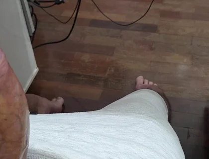 Giant Penis and Condom