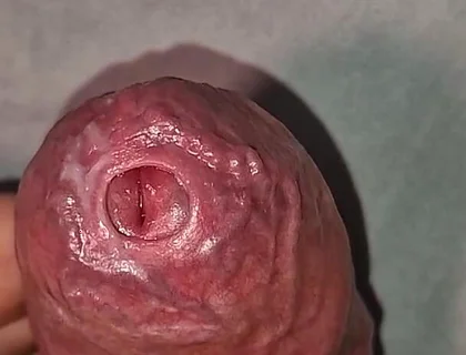 Close up on Phimosis Large Cock, so Hot!