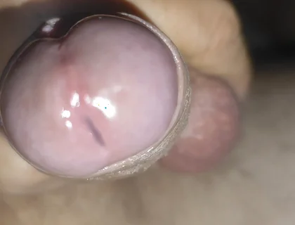 Scrotal Phimosis Results in an Extremely Hot Orgasm.