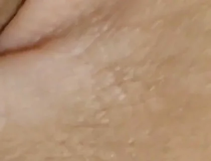 Amazing Dilator Vessel Has Disproportionate Increase.