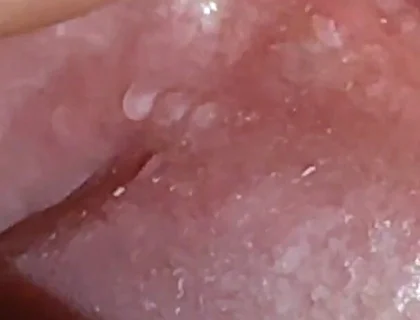 Super Daddy Enlarged Hole Pulsing with Horniness.