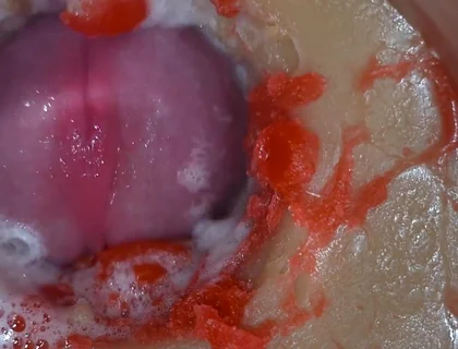 Insemination - Internal Camera Captures Deep Male Ejaculation