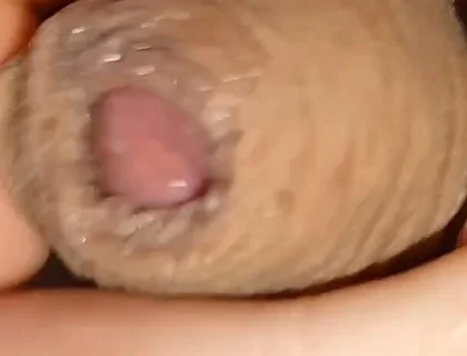 Cumshot of the Largest Phimosis Foreskin in the World.